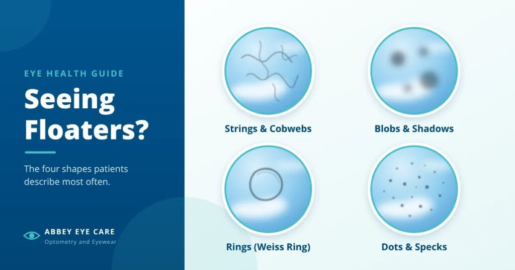Infographic titled Seeing Floaters? showing four types of eye floaters: strings and cobwebs, blobs and shadows, rings, and dots and specks.