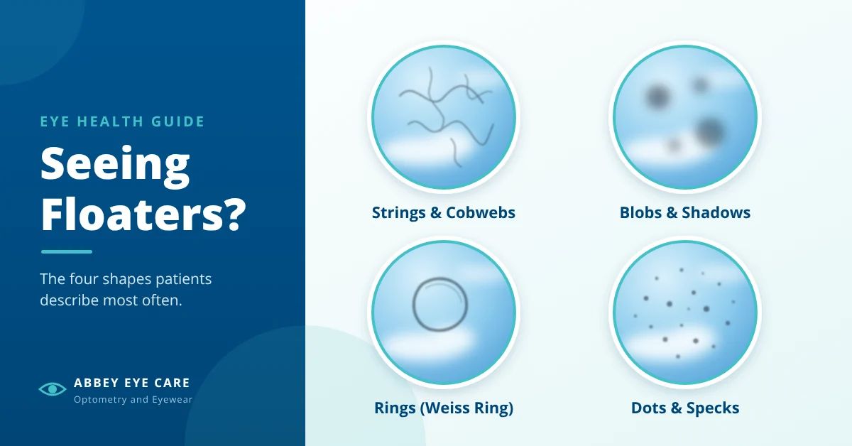 Infographic titled Seeing Floaters? showing four types of eye floaters: strings and cobwebs, blobs and shadows, rings, and dots and specks.
