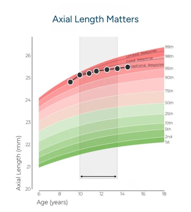 Line graph titled Axial Length Matters showing axial length (mm) increasing with age (years) from 6 to 18. Percentile bands are shaded green to red. Dots highlight data points in the 85th–98th percentiles within a gray age window.